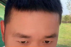 直播娱乐吃瓜能挣钱吗,揭秘如何轻松赚取收益